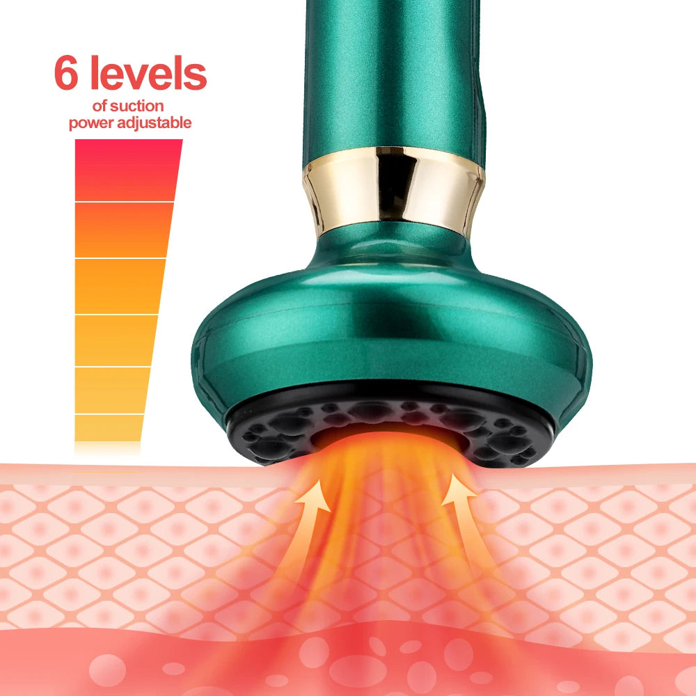 6-Level Electric Cupping Massager
